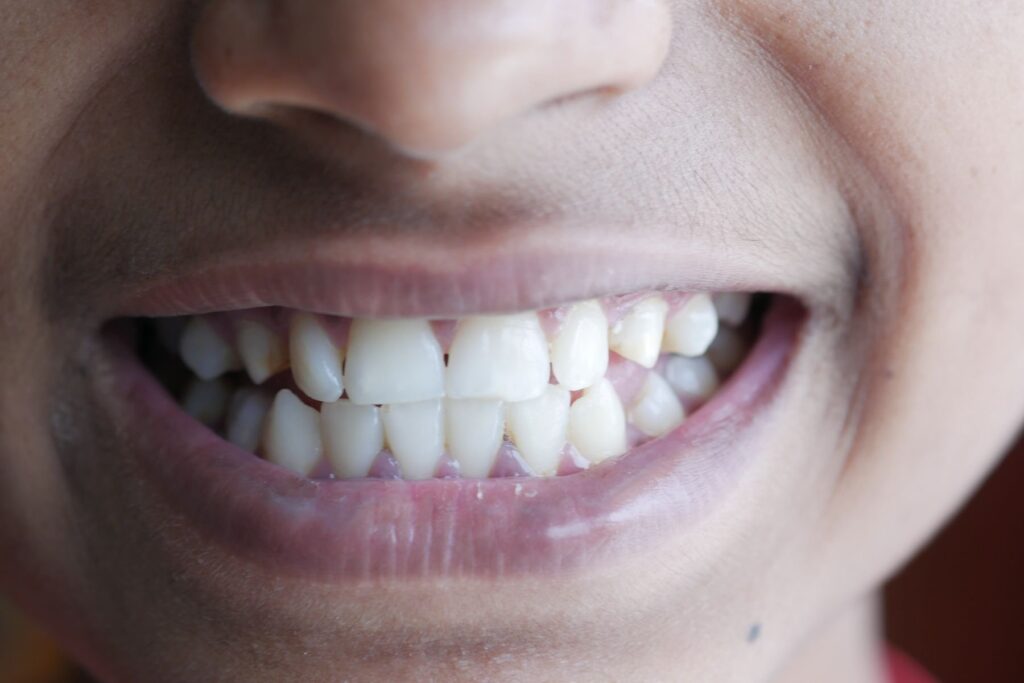 Close-up of a smile showing healthy white teeth
